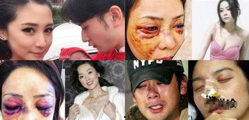 明星毁容事件,揭开娱乐圈背后的伤痛与真相